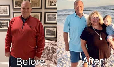 Before and After Photos of Florida's Premier Wellness Medical Group in Tampa, FL