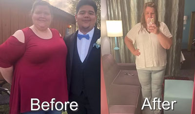 Before and After Photos of Florida's Premier Wellness Medical Group in Tampa, FL